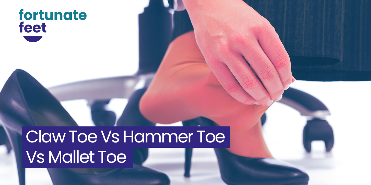 Claw Toe Vs Hammer Toe Vs Mallet Toe What Are The Differences