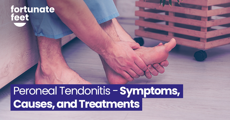 Peroneal Tendonitis Symptoms Causes And Treatments Fortunate Feet