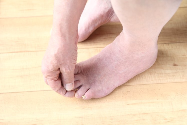 Claw Toe Vs Hammer Toe Vs Mallet Toe - What Are The Differences ...