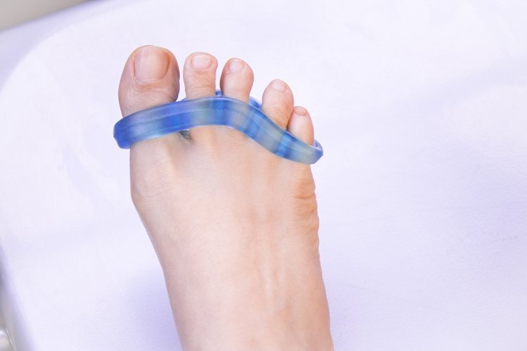 Best Hammer Toe Straighteners In 2023 Fortunate Feet   Toe Separator 