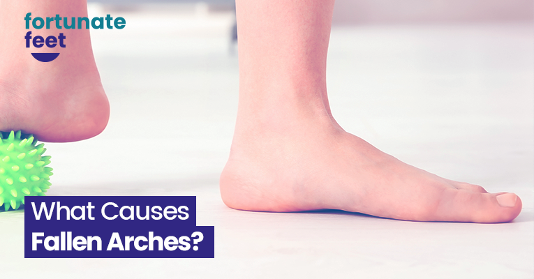 what-causes-fallen-arches-fortunate-feet