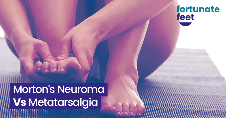 Morton's Neuroma vs. Metatarsalgia: Differences And Similarities ...