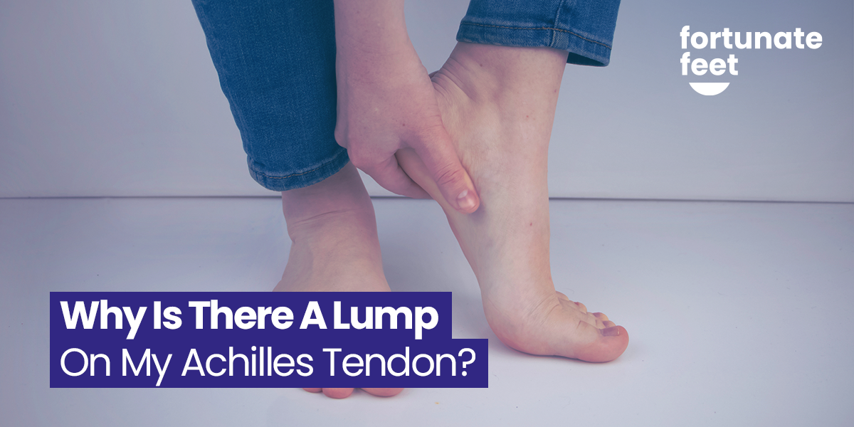 Why Is There A Lump On My Achilles Tendon Fortunate Feet