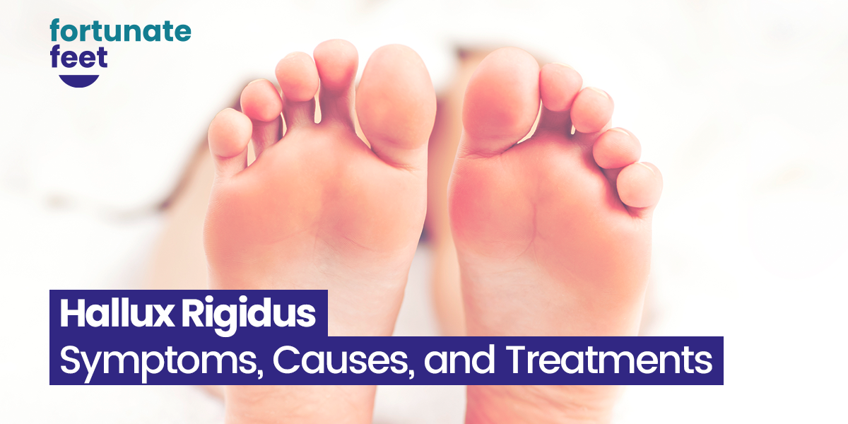 Hallux Rigidus Symptoms Causes And Treatments Fortunate Feet