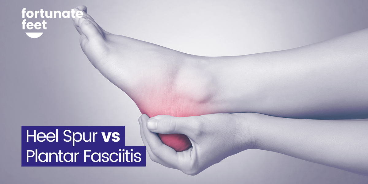 heel-spur-vs-plantar-fasciitis-similarities-and-differences