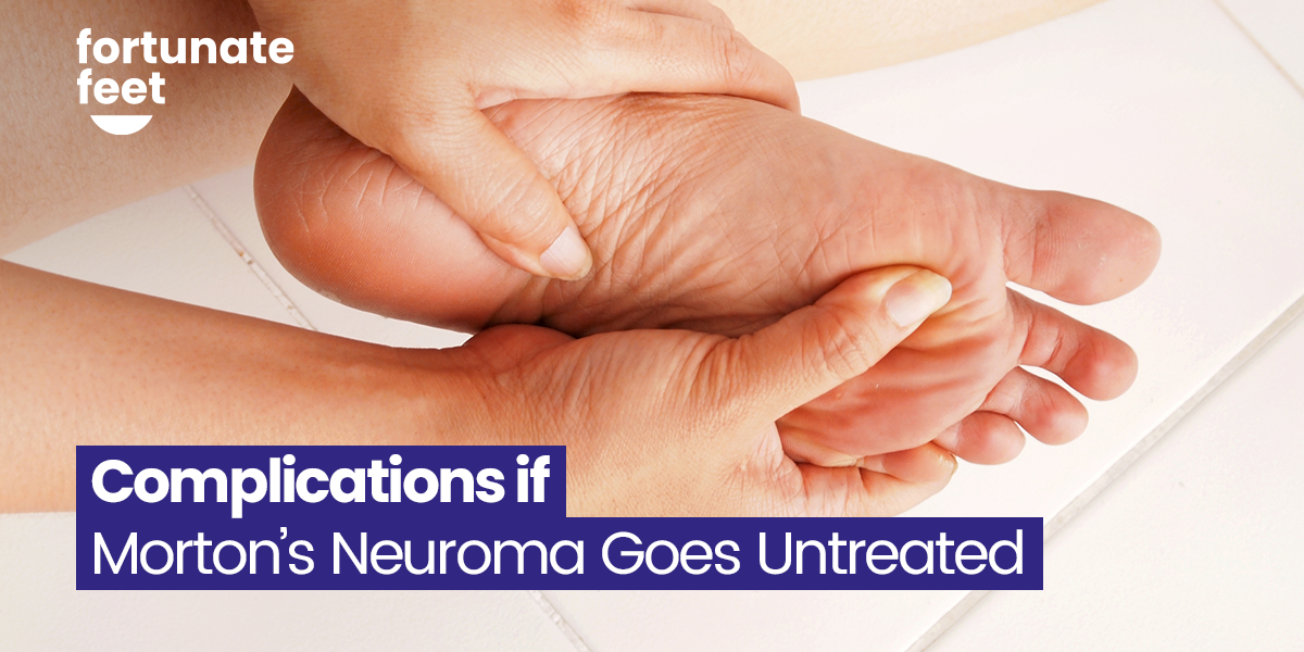 Complications If Morton’s Neuroma Goes Untreated - Fortunate Feet