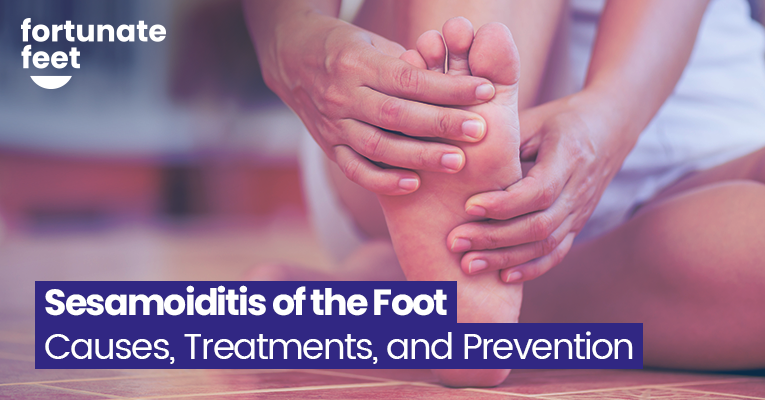 Sesamoiditis of the Foot - Causes, Treatments, and Prevention ...