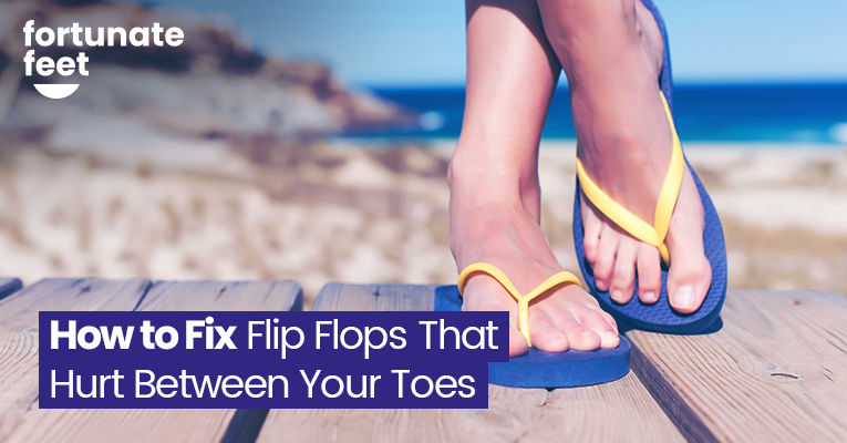 How to Fix Flip Flops That Hurt Between Your Toes - Fortunate Feet