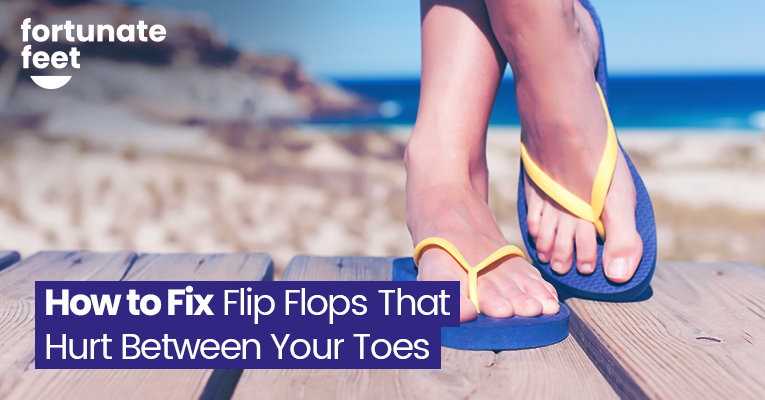 how-to-fix-flip-flops-that-hurt-between-your-toes-fortunate-feet