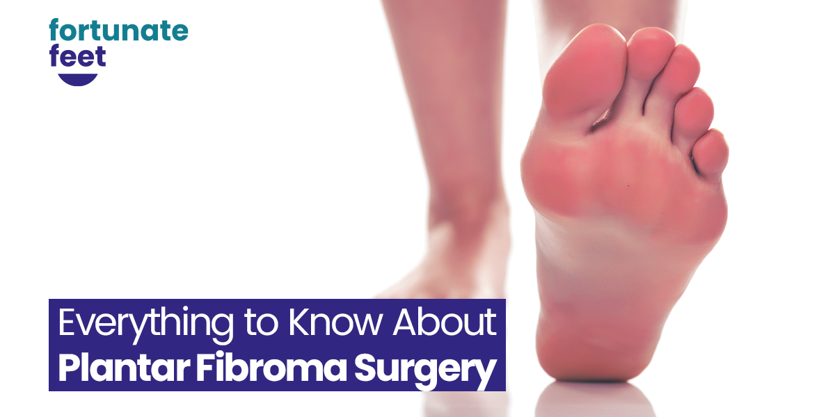 Everything to Know About Plantar Fibroma Surgery Fortunate Feet